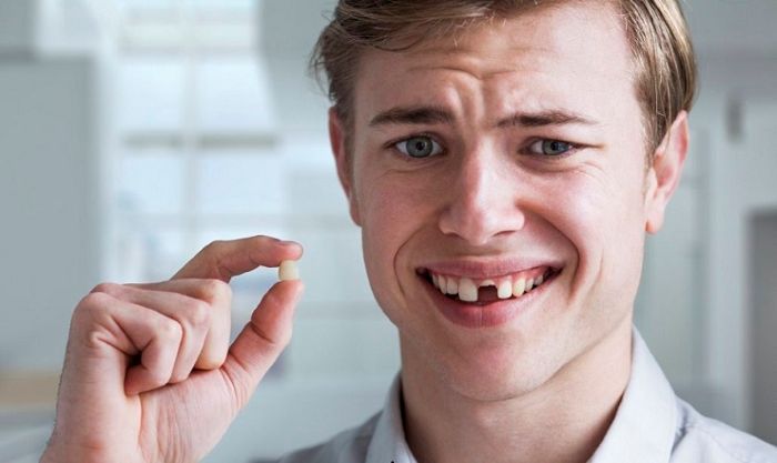 Nằm mơ thấy rụng răng cửa cũng là dấu hiệu báo động cho sức khỏe răng miệng
